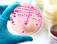 Cómo cultivar bacterias en una placa de Petri