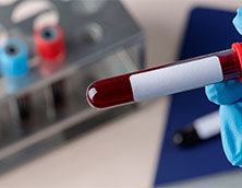 ¿Qué es el tubo de recogida de sangre y por qué es importante? 